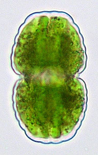 Cosmarium benedictum